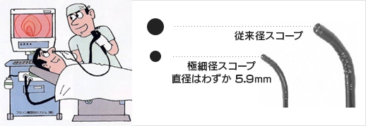 内視鏡